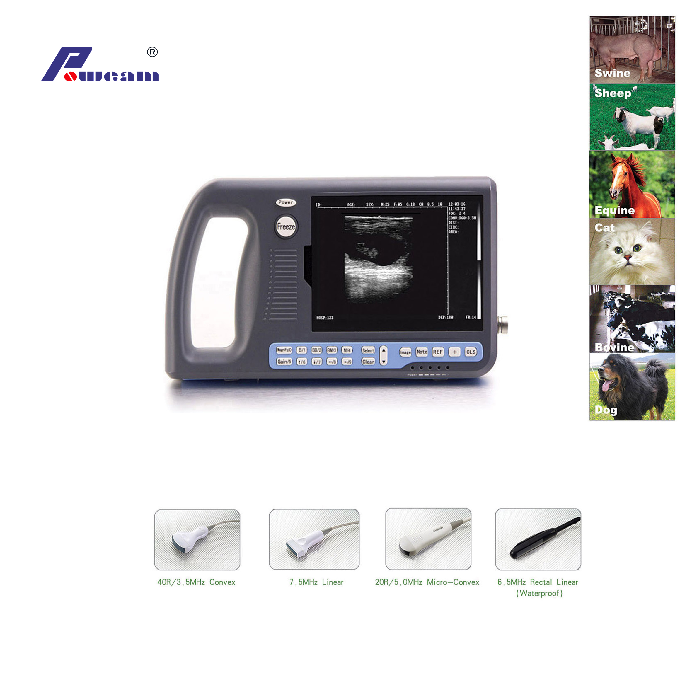 Digital-Palmtop-Ultraschallscanner (wwwb3000)