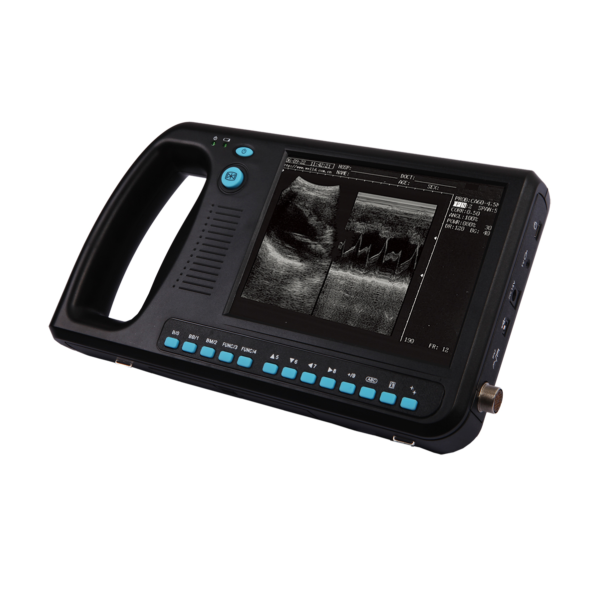 Medizinischer Digital Palm Smart Cow Veterinär-Ultraschall-Scanner