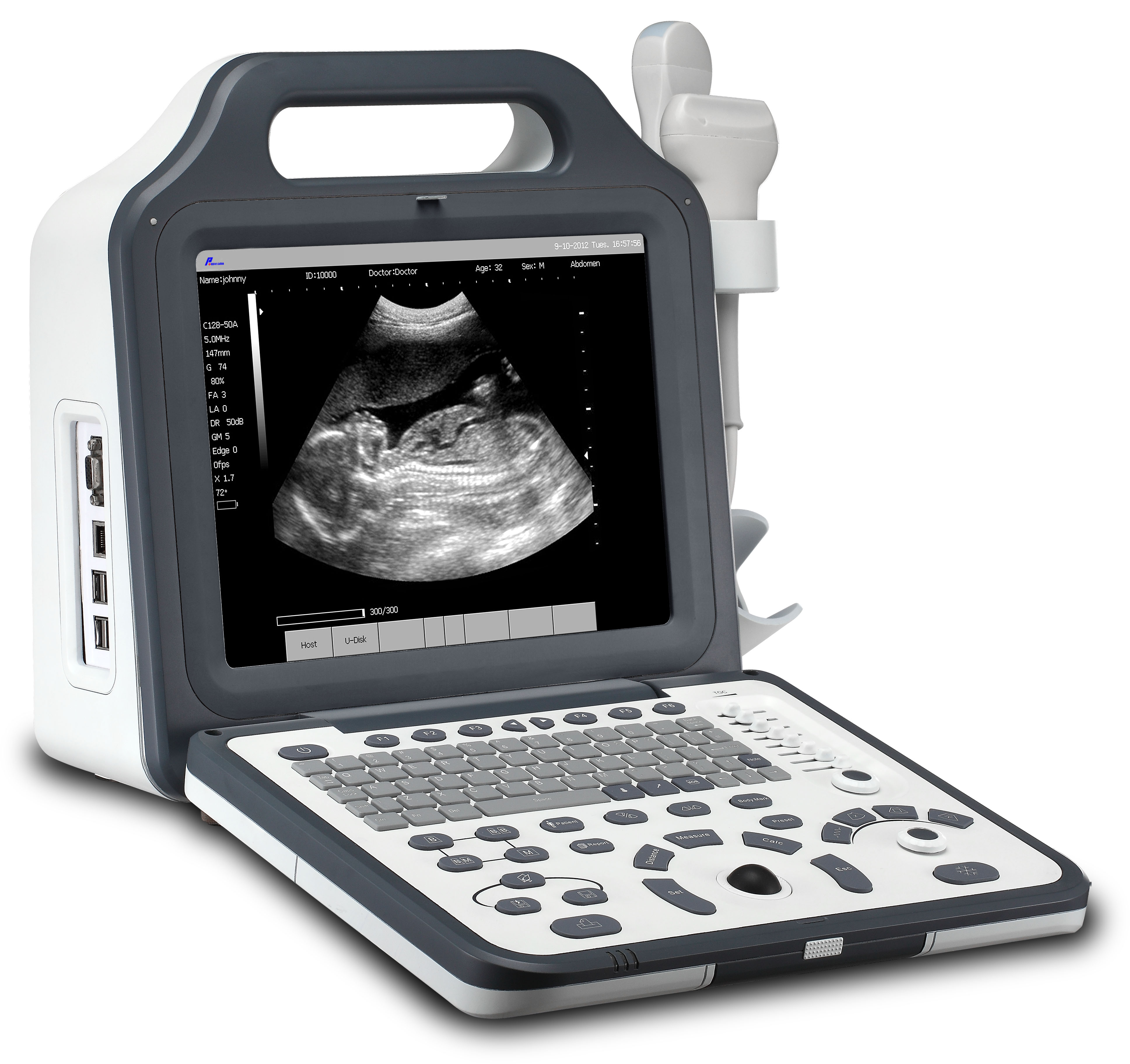 Krankenhaus 12.1 "LCD-Digital-Laptop-Ultraschall (WELTC60P)